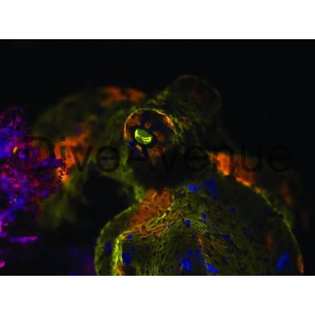 Filtre fluorescence ØM67mm Bigblue YF67